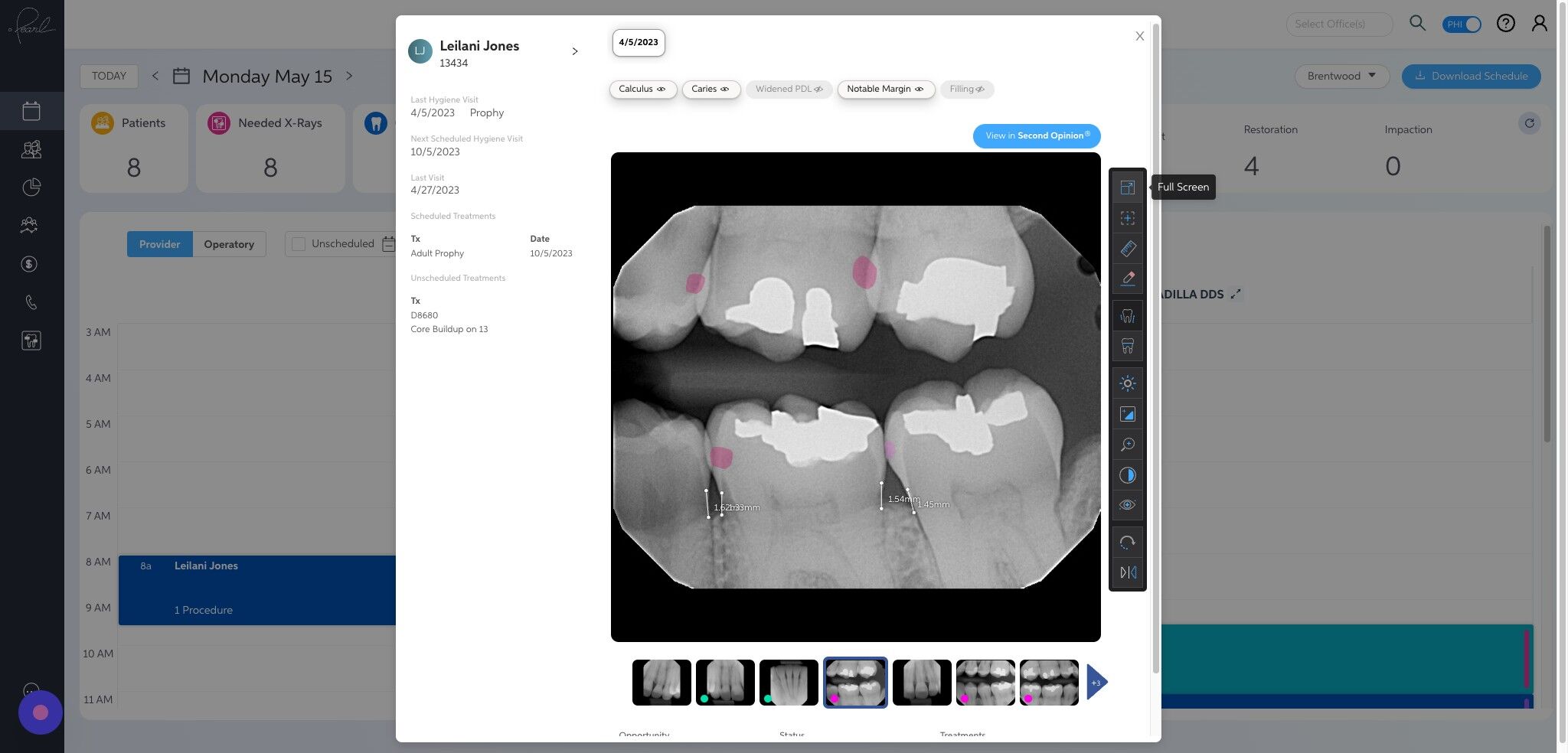 Screenshot of: On the right-hand side of the radiographs you have all the tools that can be found in your Second Opinion® software.