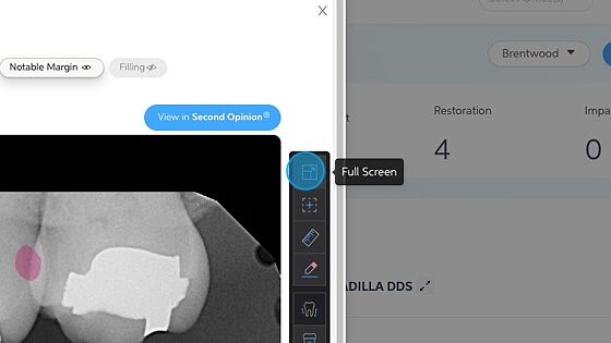 Screenshot of: On the right-hand side of the radiographs you have all the tools that can be found in your Second OpinionĀ® software.