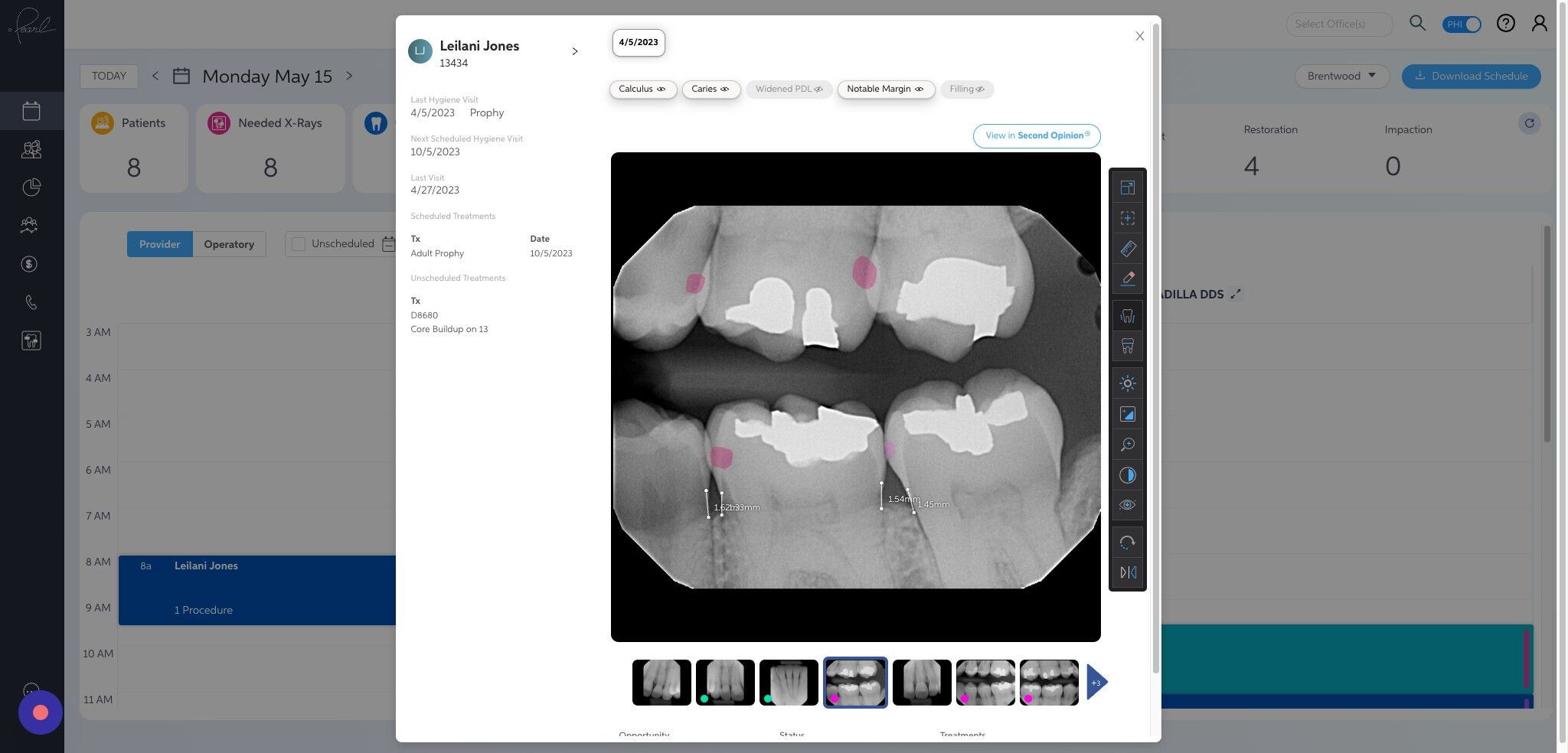 Screenshot of: Clicking on 