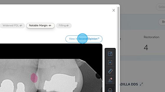 Screenshot of: Clicking on