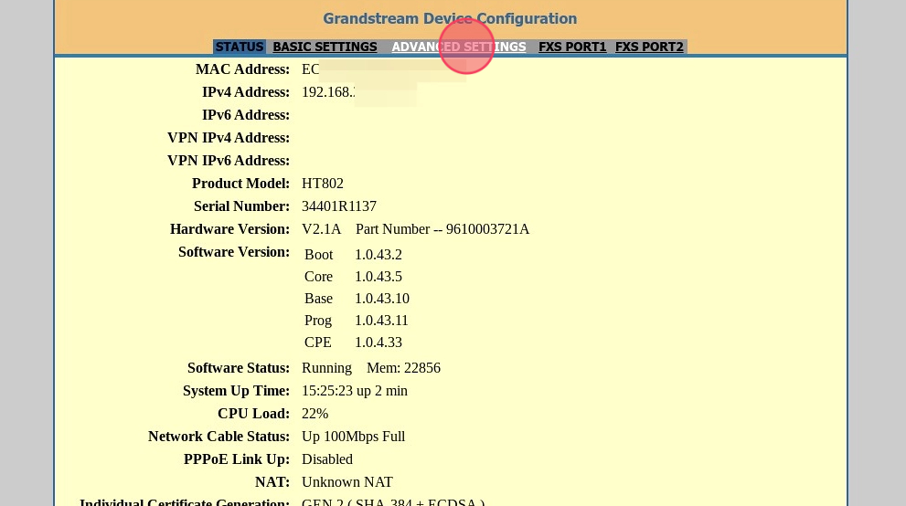 Advanced setting in grandstream
